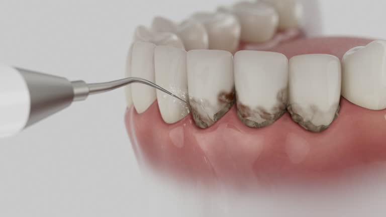 Reliable Dental Implants contractor in Everett, PA by Smile Center Dentistry
